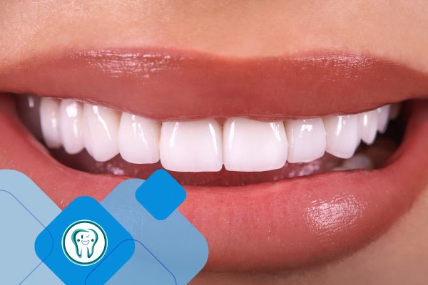 تراش دندان برای روکش سرامیکی