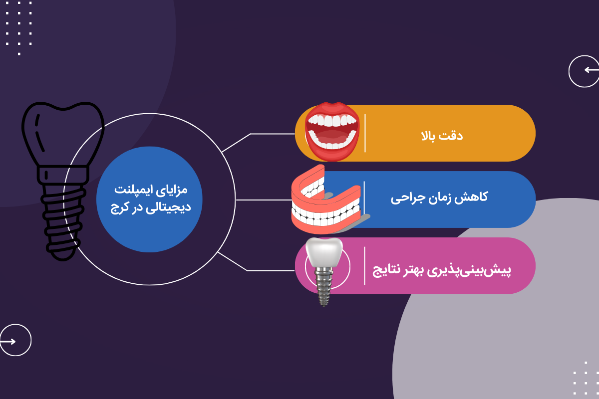 مزایای ایمپلنت دیجیتال در کرج