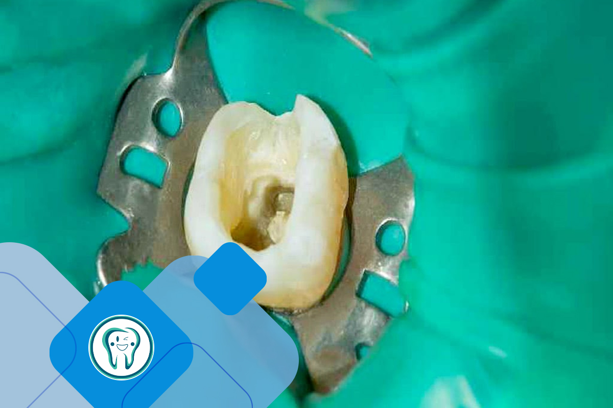 Common root problems