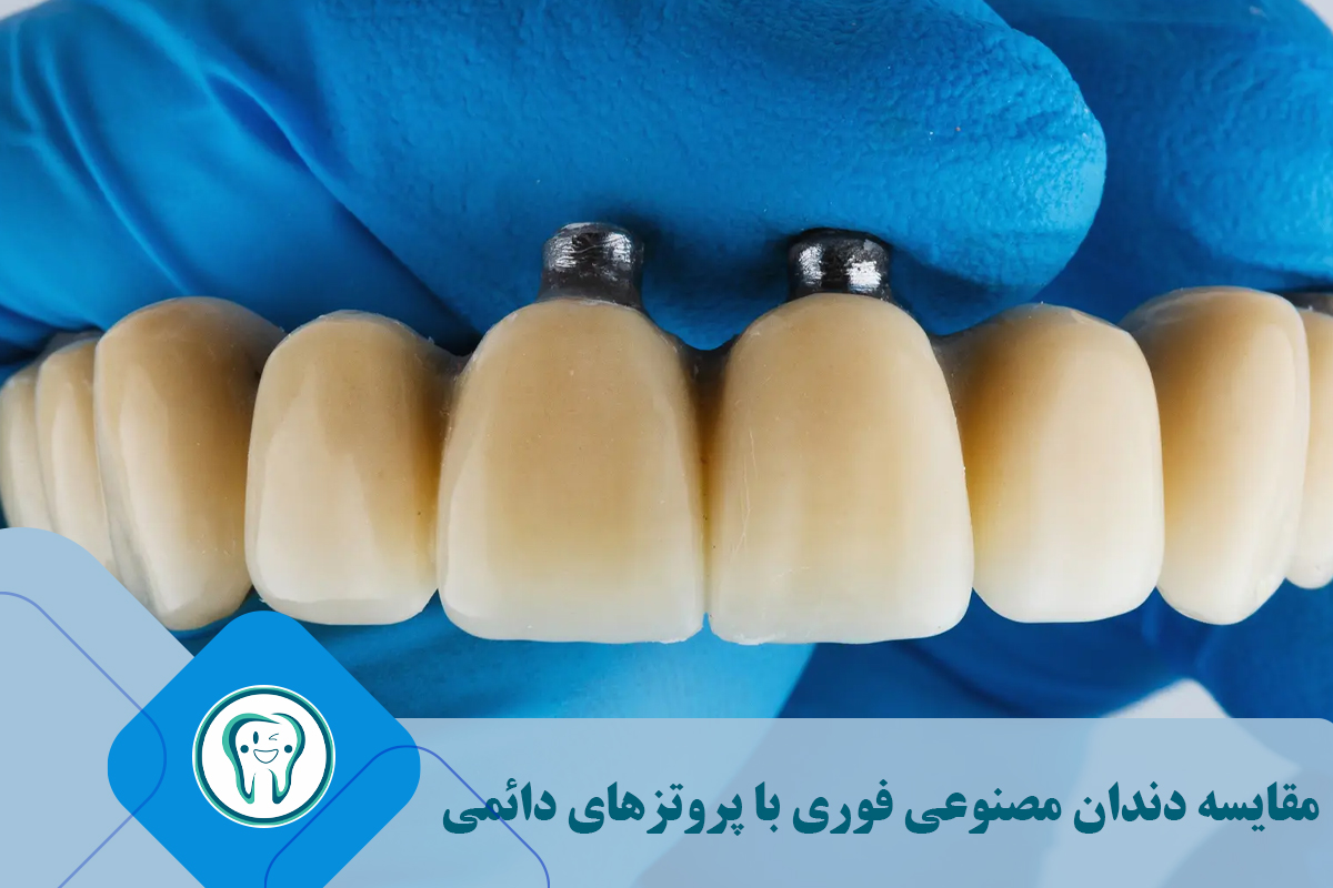 دندان مصنوعی فوری در مقایسه با پروتزهای دائمی