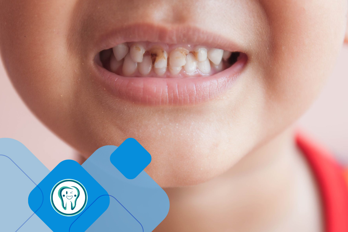 اهداف دندانپزشکی ترمیمی اطفال  