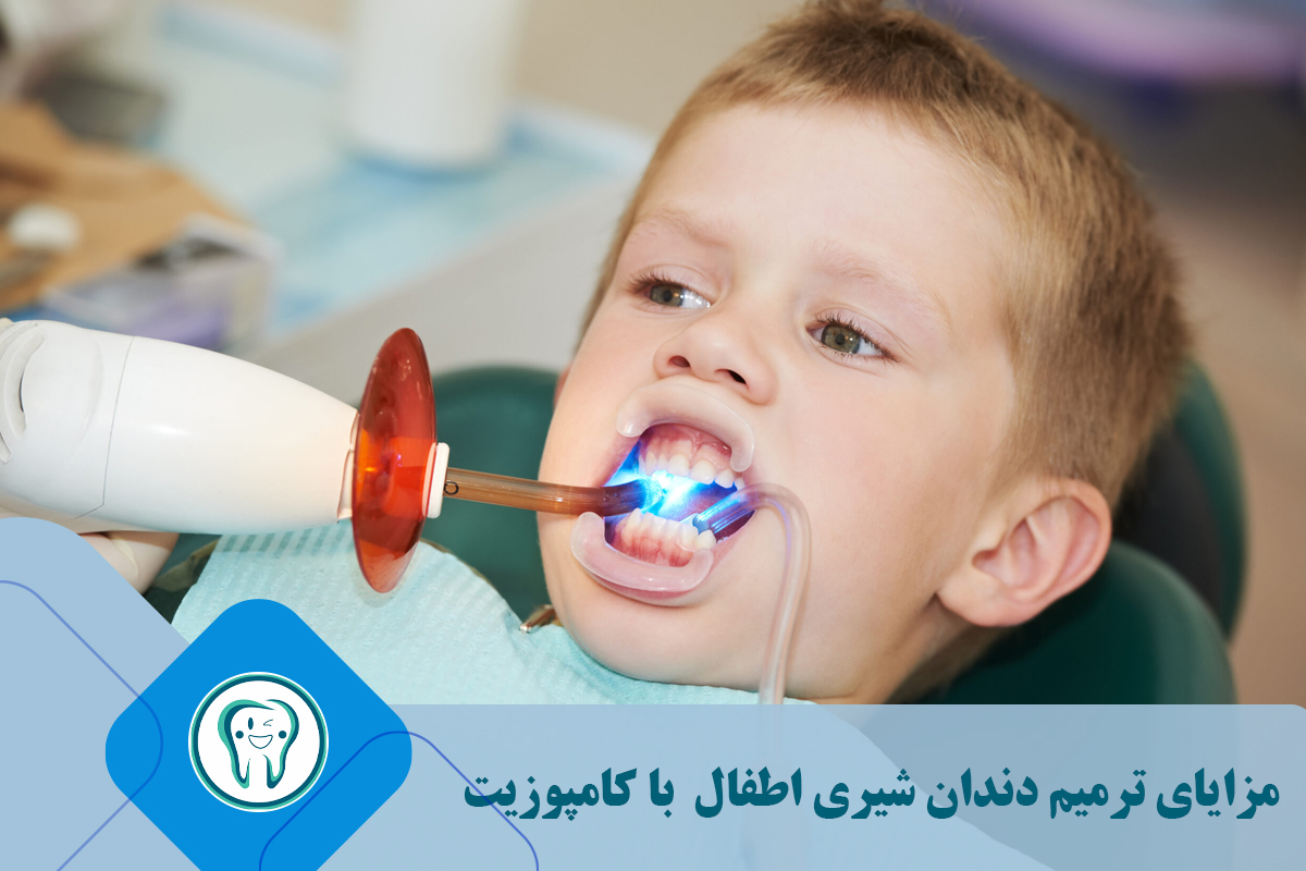مزایای ترمیم دندان شیری اطفال  با کامپوزیت