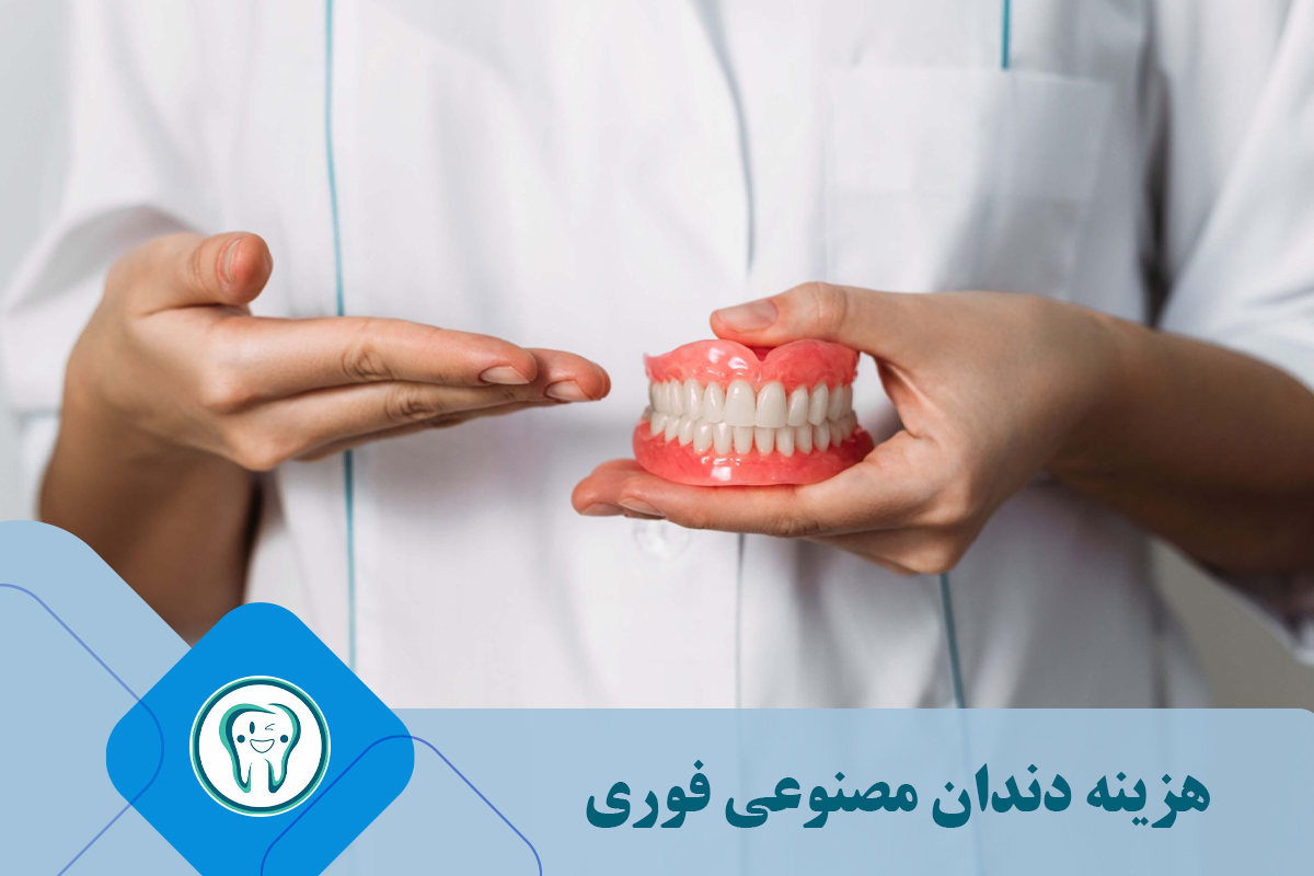 هزینه دندان مصنوعی فوری