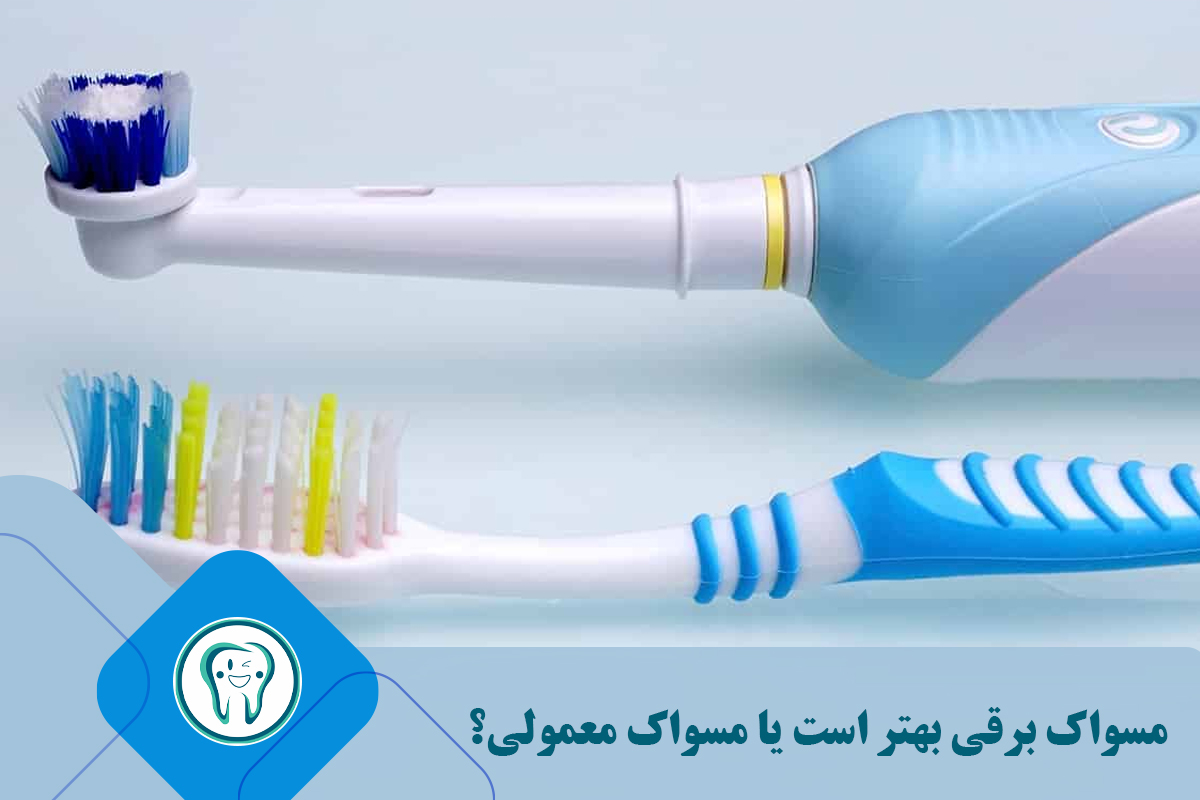 مسواک برقی یا مسواک معمولی