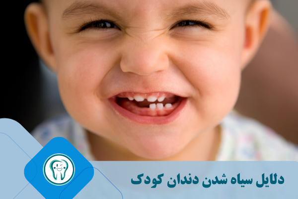درمان خانگی سیاهی دندان کودک