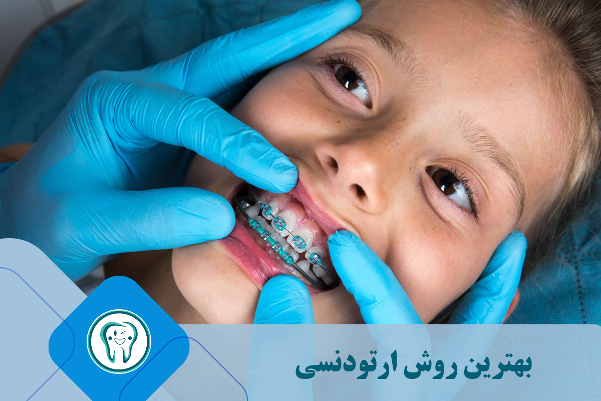 بهترین روش ارتودنسی 