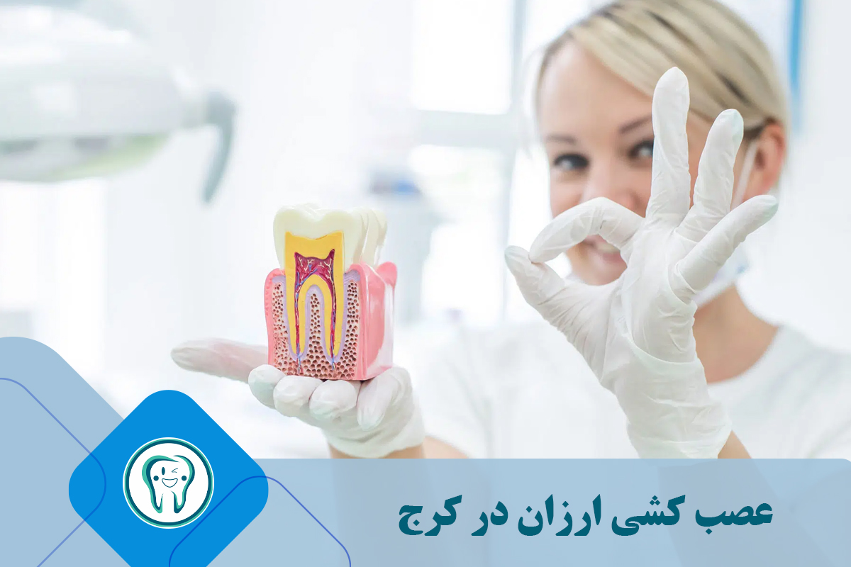 عصب کشی ارزان در کرج 