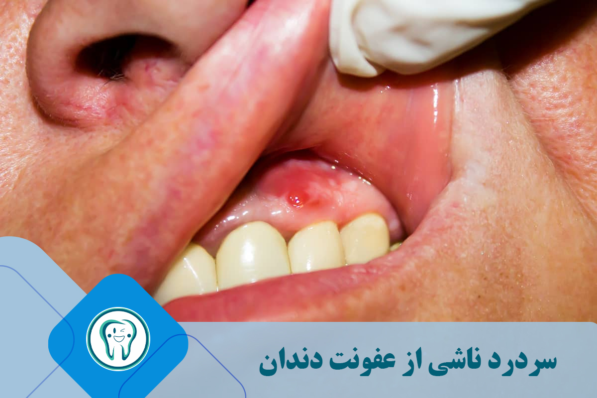 سردرد ناشی از عفونت دندان