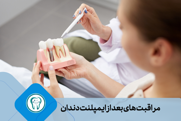 نکات مهم برای مراقبت های بعد از ایمپلنت دندان