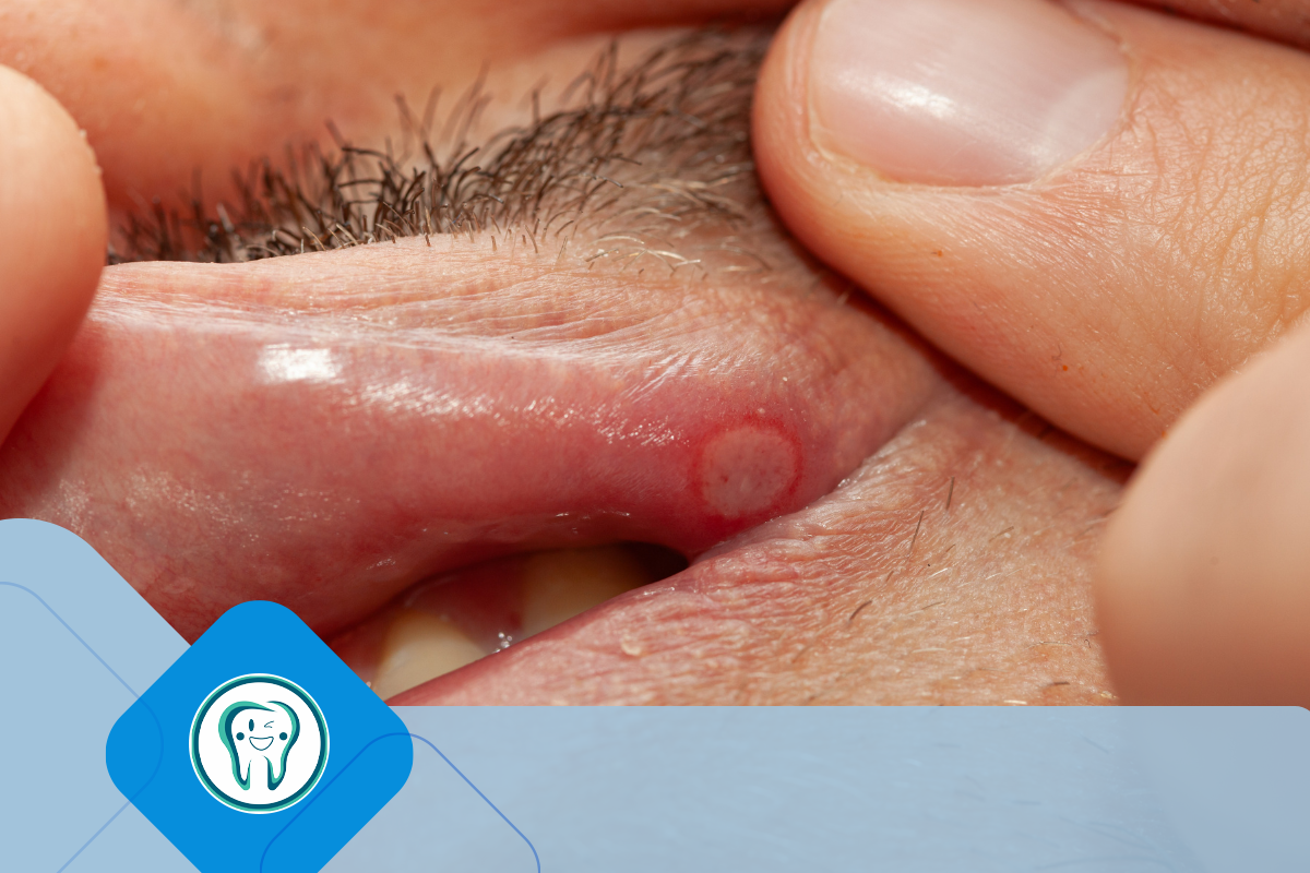 درمان‌های خانگی برای درمان زخم‌های دهان با عسل