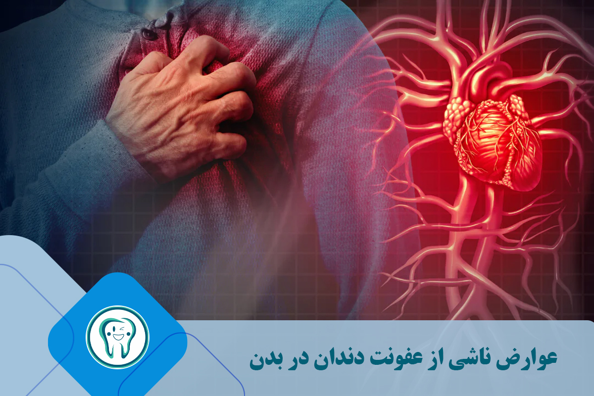 عوارض ناشی از عفونت دندان در بدن