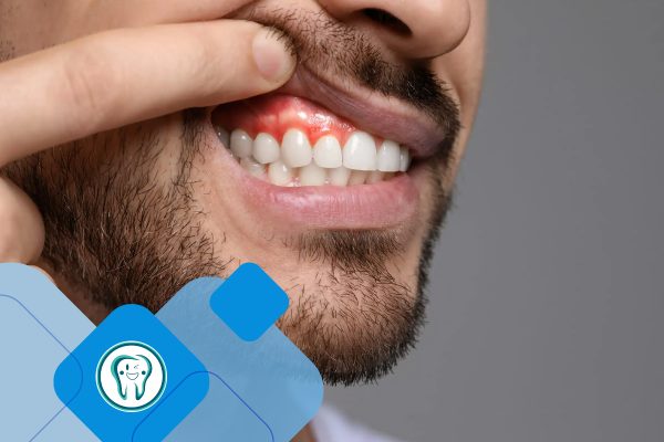 عفونت دندان در بدن