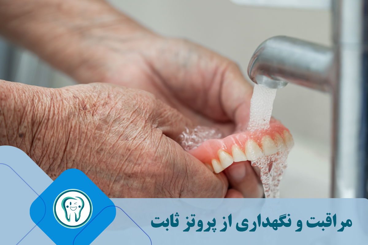 مراقبت و نگهداری از پروتز ثابت