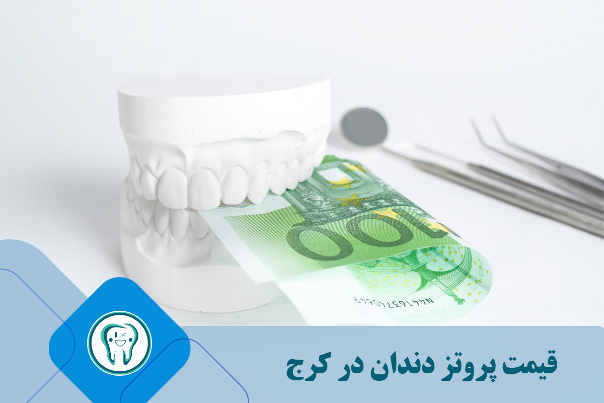 قیمت پروتز دندان در کرج   