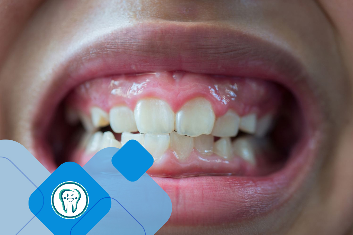 مشکلات و عوارض جلو بودن فک پایین