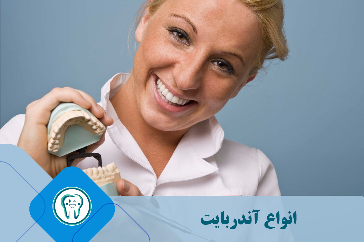 دسته‌بندی انواع آندربایت
