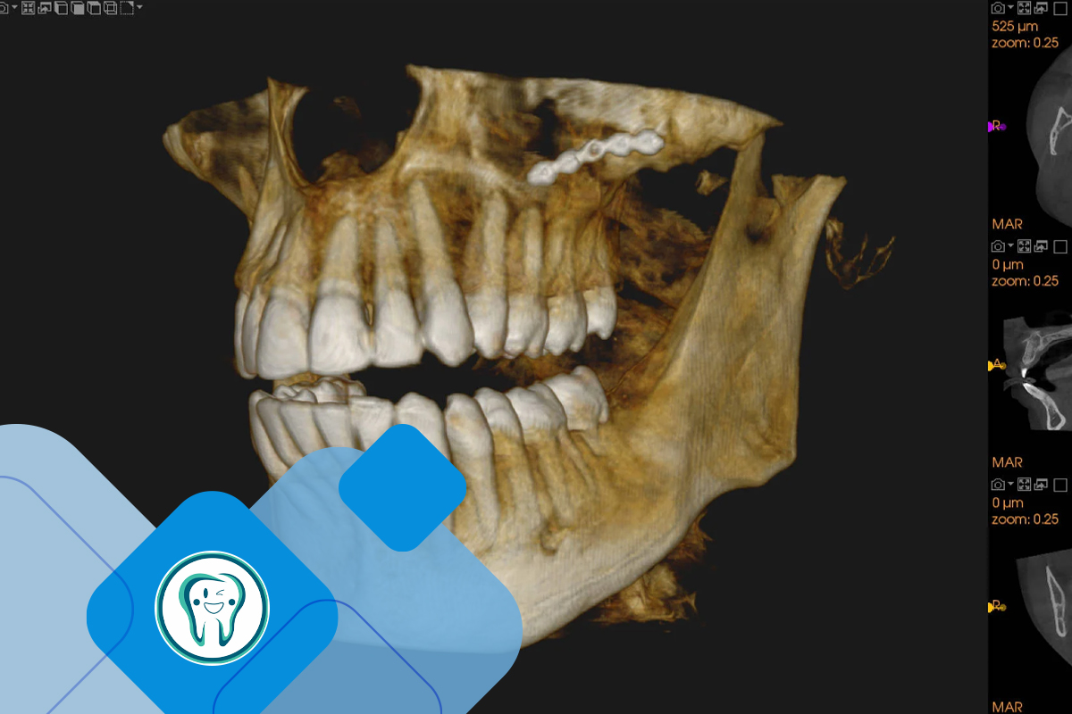 راه‌های تشخیص آنکیلوز