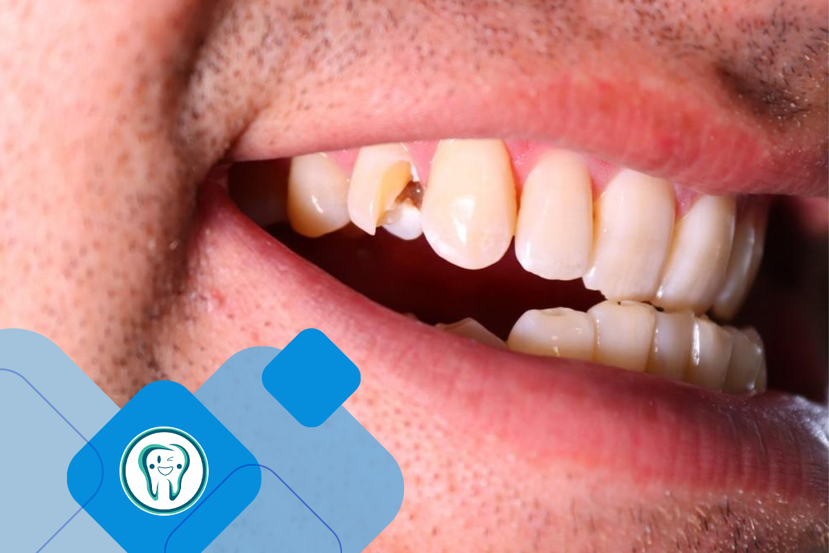 عوارض احتمالی و خطرات درمان ریشه