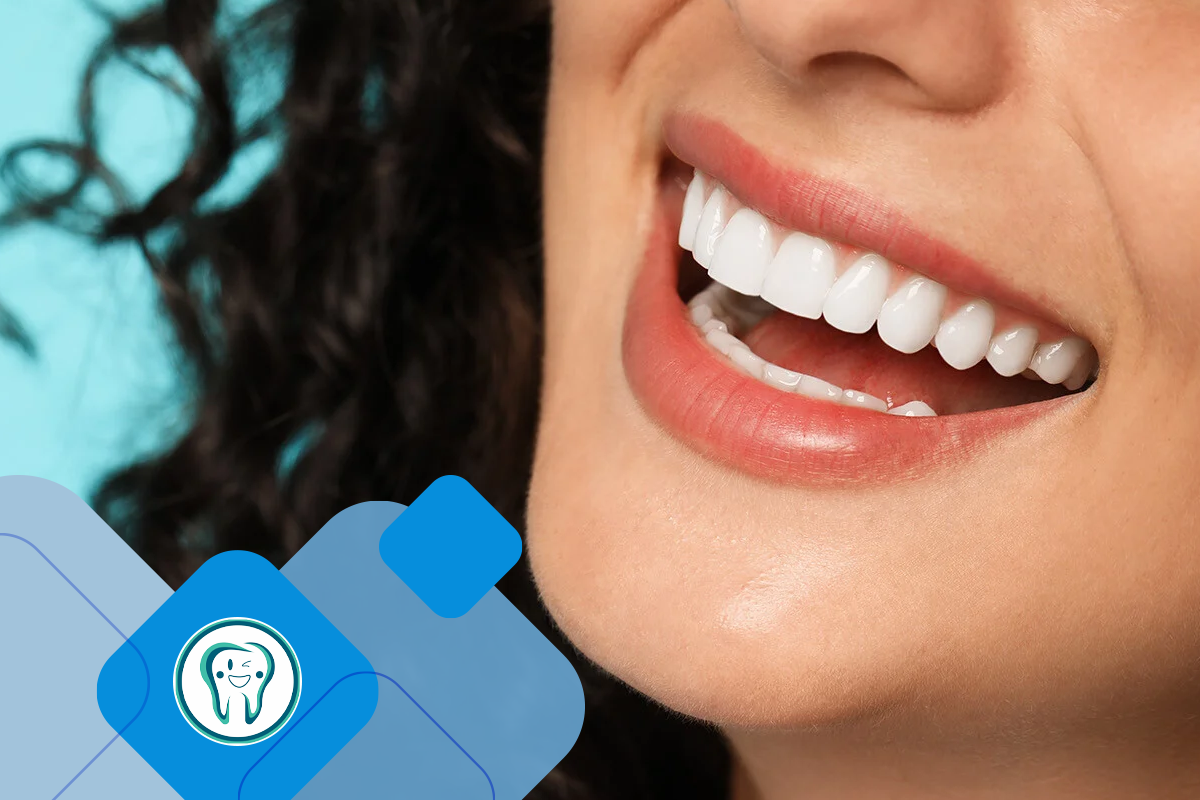 انواع روکش دندان برای زیبایی