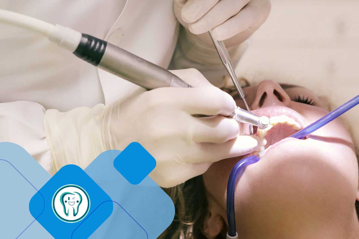 
مزایا و معایب جرم‌گیری دندان