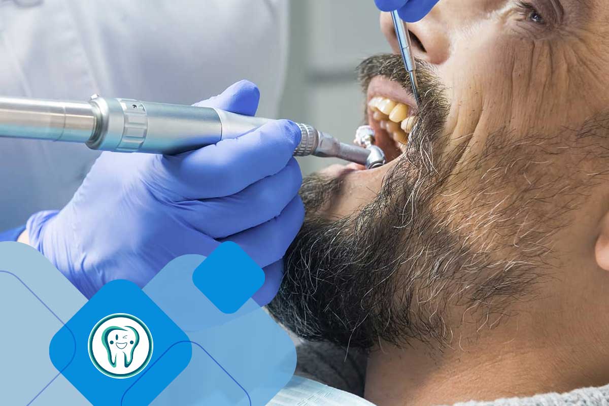 جرم‌گیری دندان 