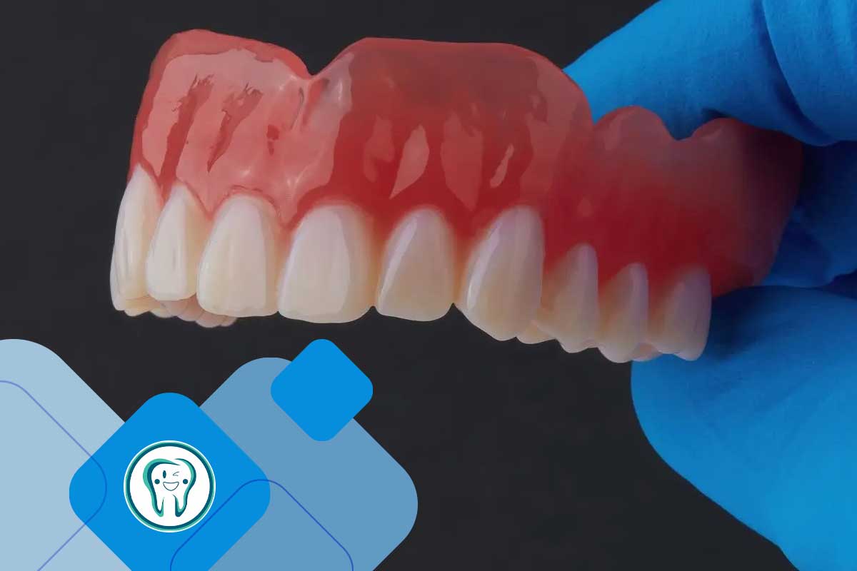 قیمت دندان مصنوعی در شهریار