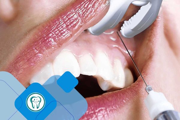 دگزامتازون برای دندان درد