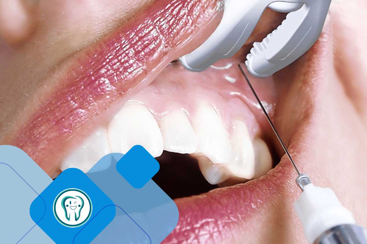 دگزامتازون برای دندان درد