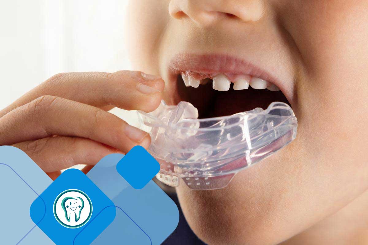 پیشگیری از لق شدن دندان دائمی کودکان