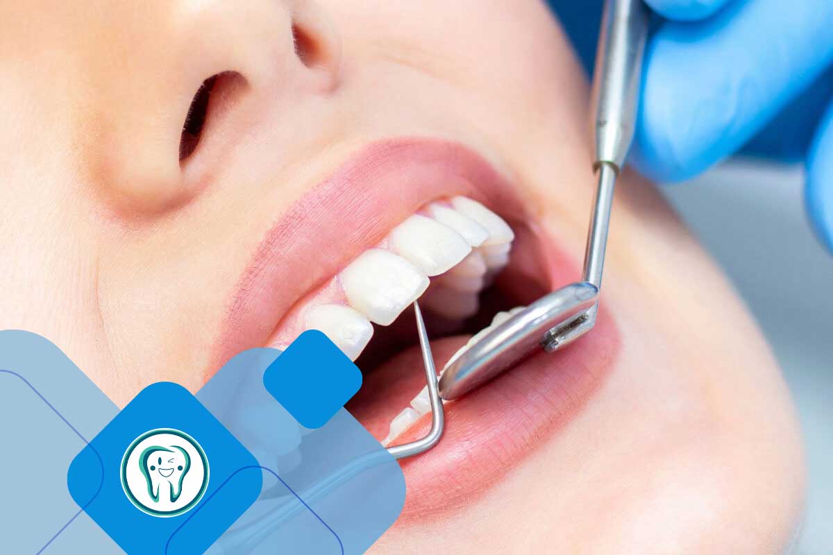  جرم گیری دندان و لثه