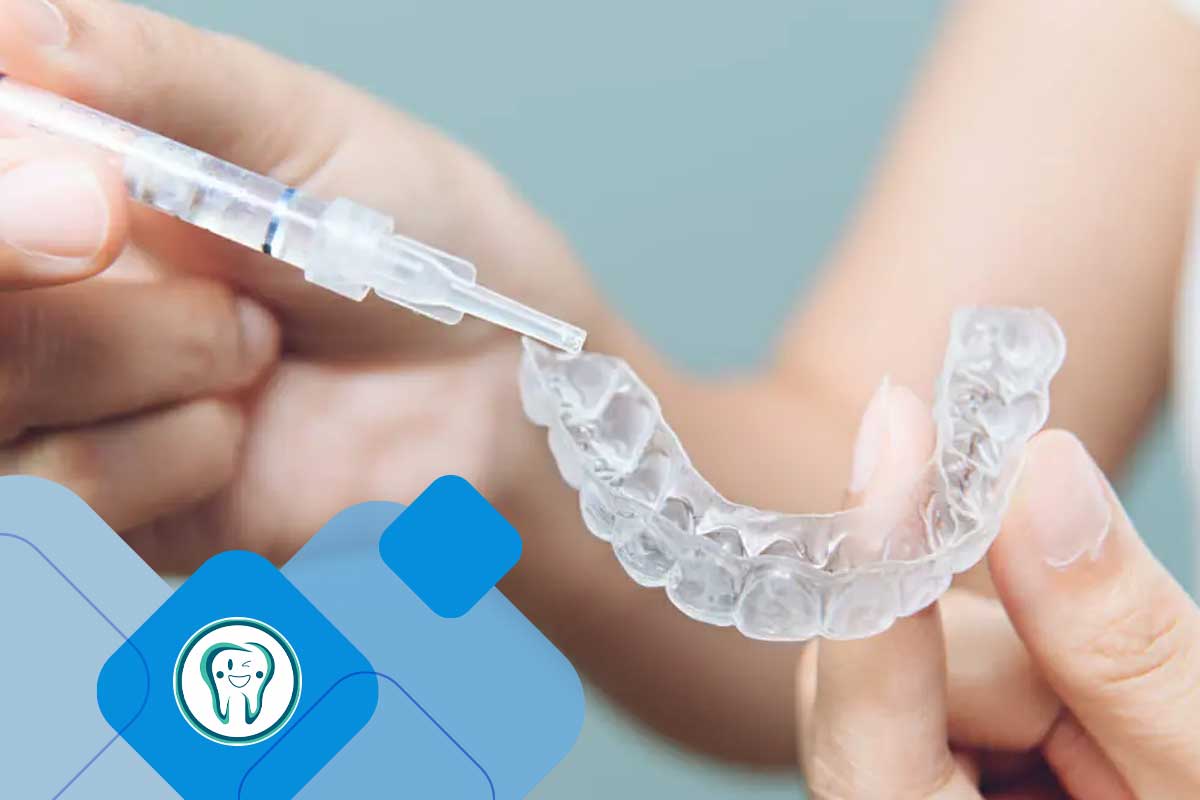 ژل ضد حساسیت بلیچینگ دندان