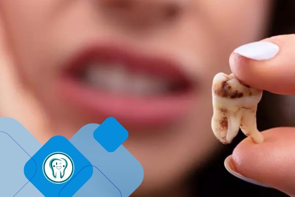 احساس پوسیدگی دندان