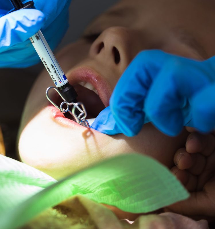child to the dentist child in the dental chair J5T3YLC scaled 1