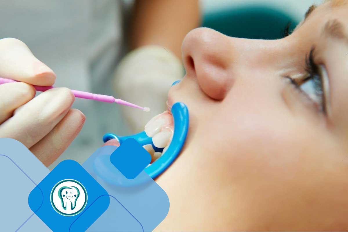 فلورایدتراپی