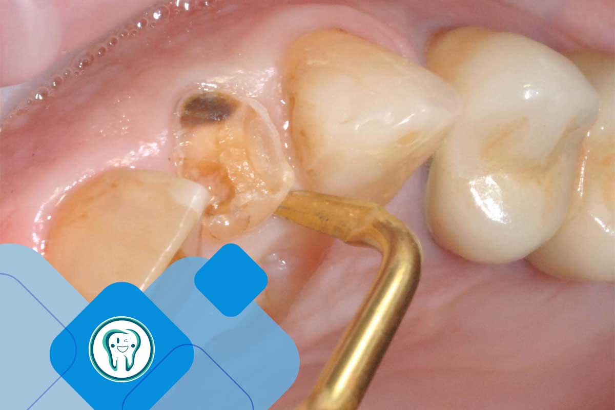 نحوه عملکرد فناوری پیزوسرجری