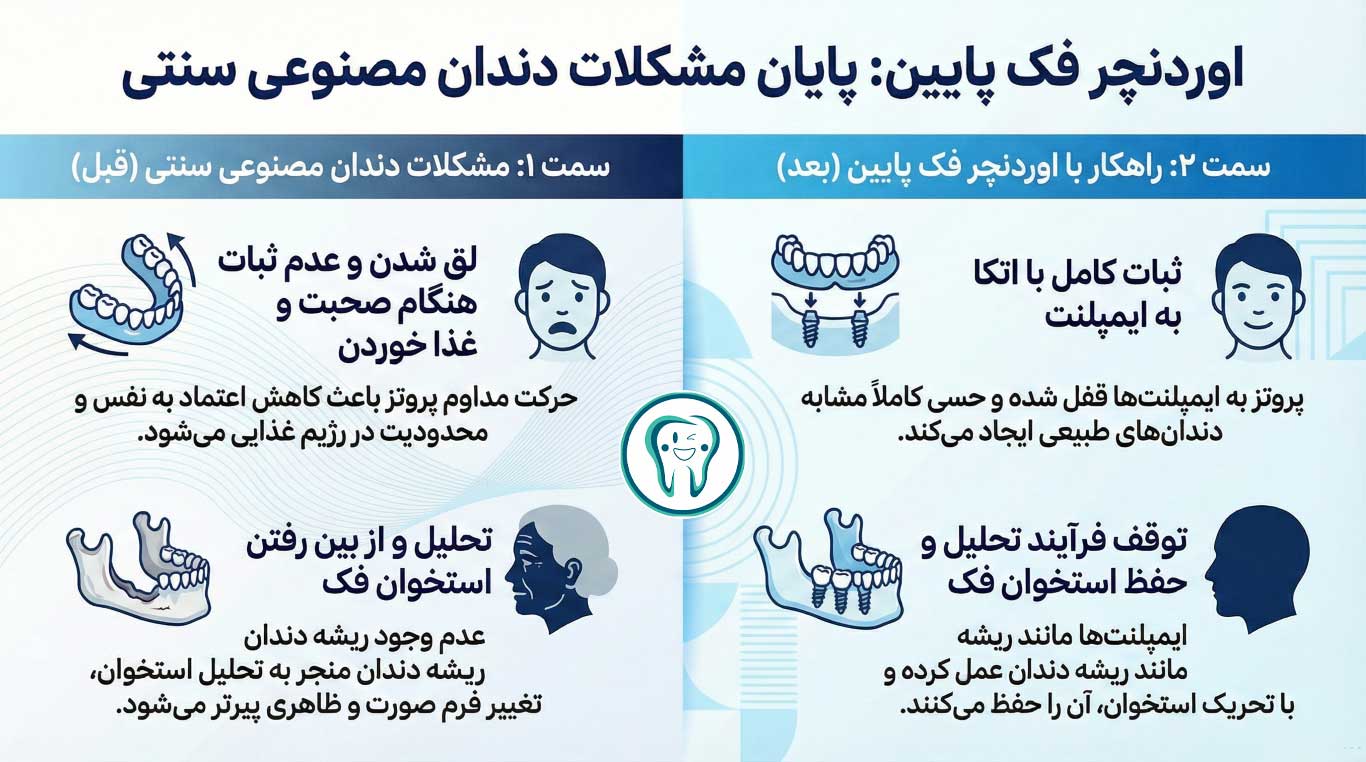 مزایای مهم اوردنچر فک پایین