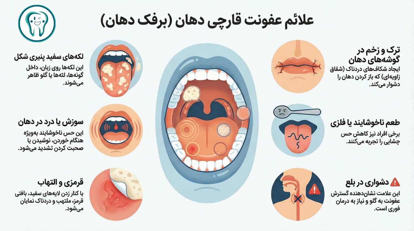 علائم و نشانه های عفونت قارچی دهان