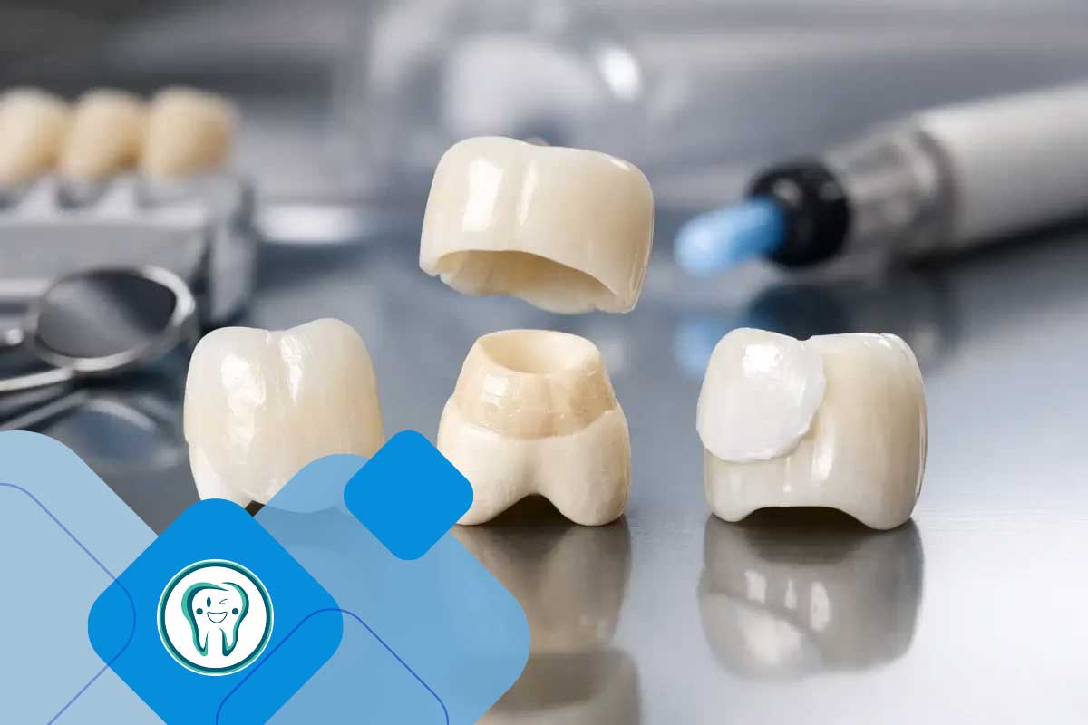 تفاوت دندان موقت قبل از ایمپلنت با روکش دائمی