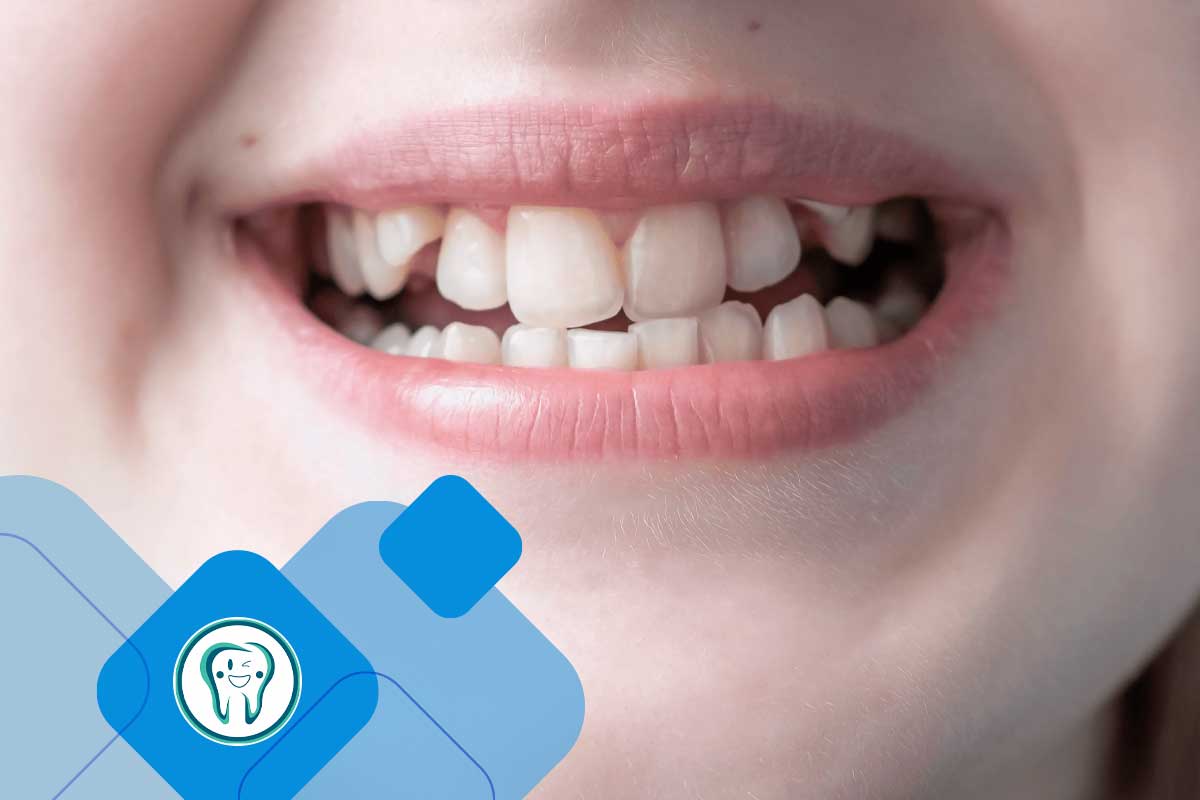 مشکلات بایت دندان