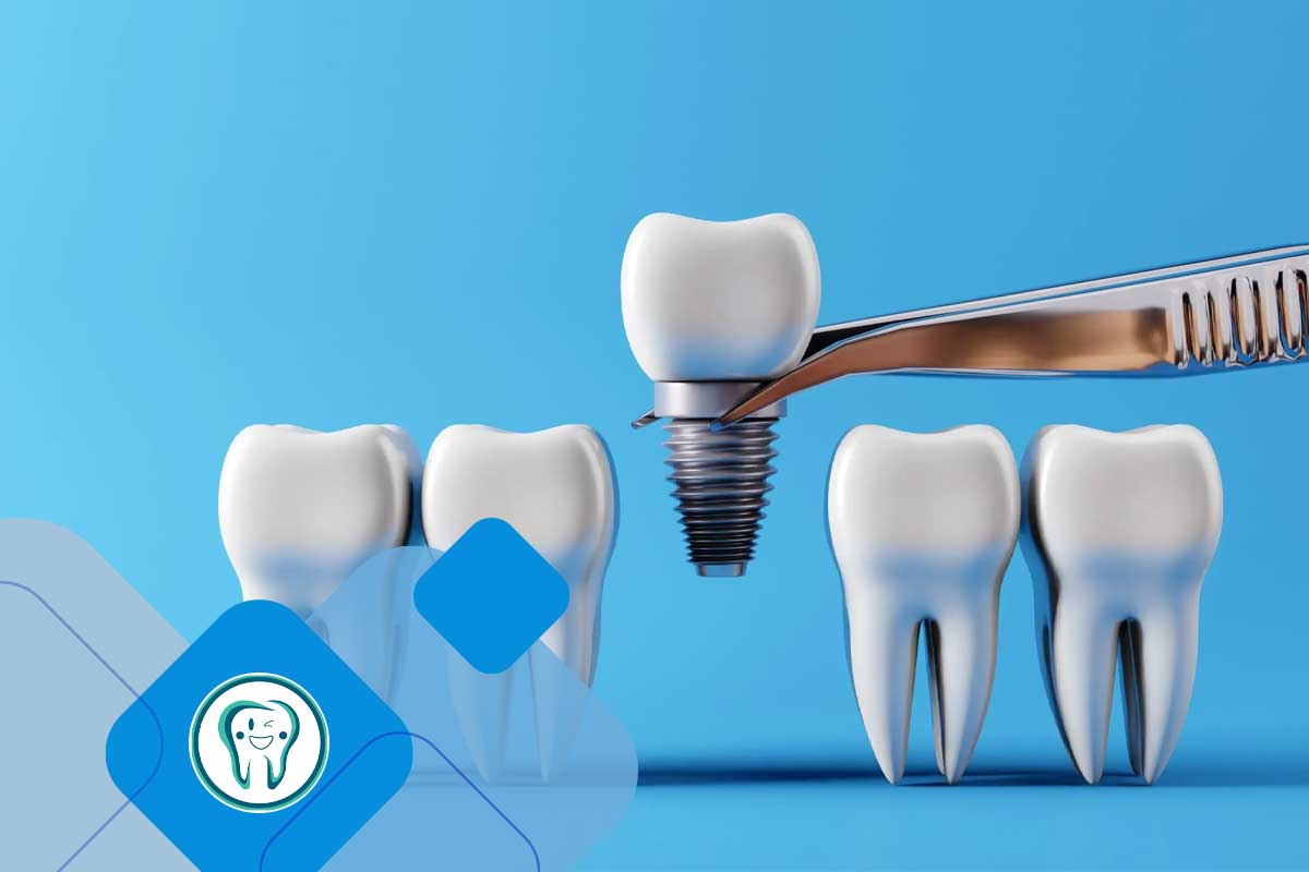 ایمپلنت دندان