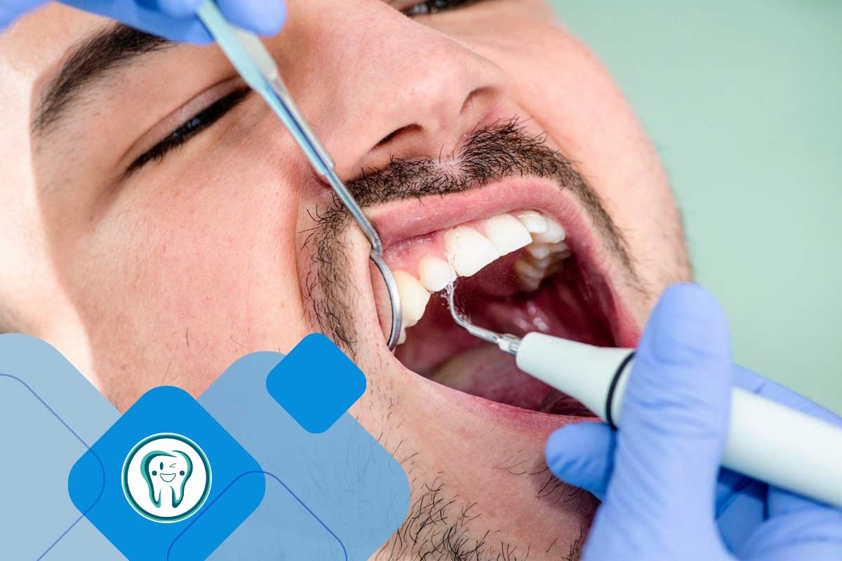 جرمگیری دندان 