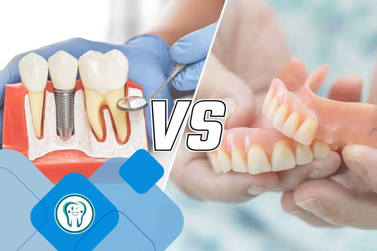 دندان مصنوعی و ایمپلنت