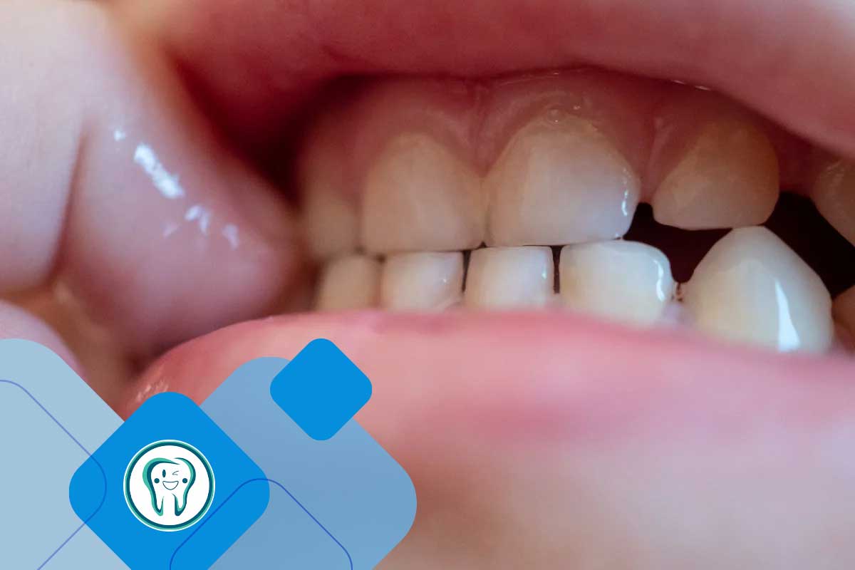 دندان قروچه 