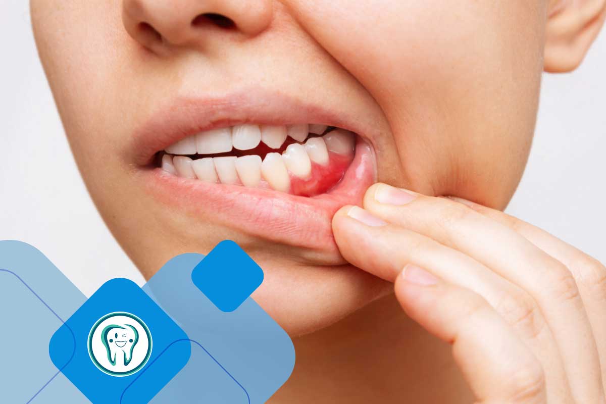 علائم هشداردهنده عفونت دندان