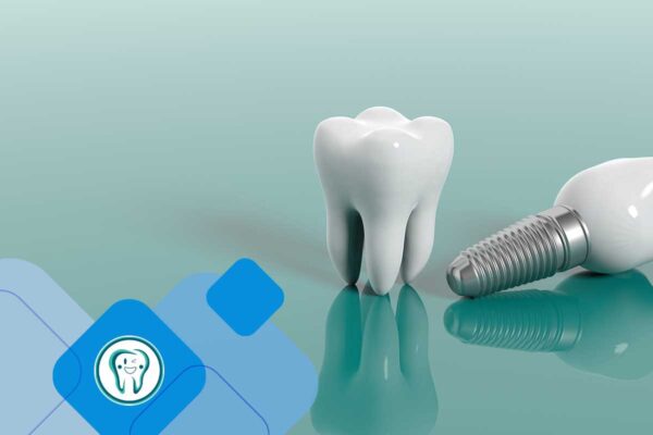 golden time for implants after tooth extraction