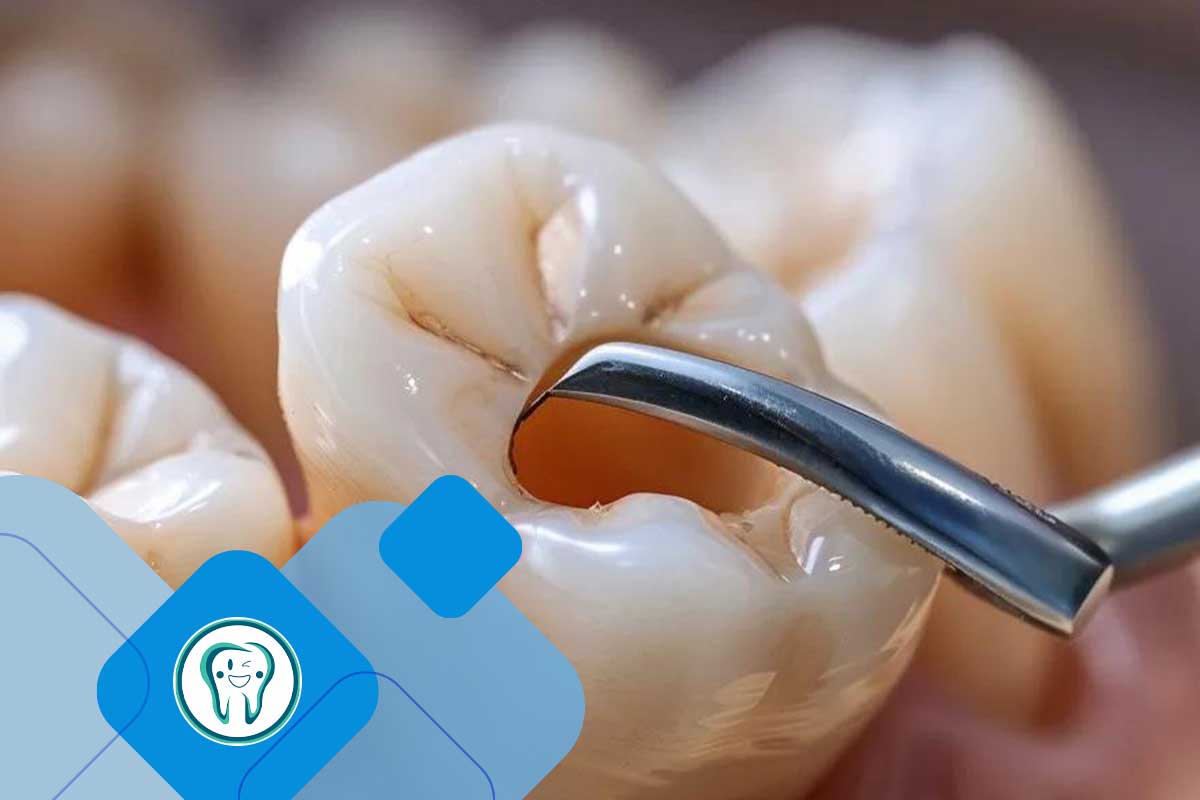 فرق کشیدن دندان با جراحی چیست؟