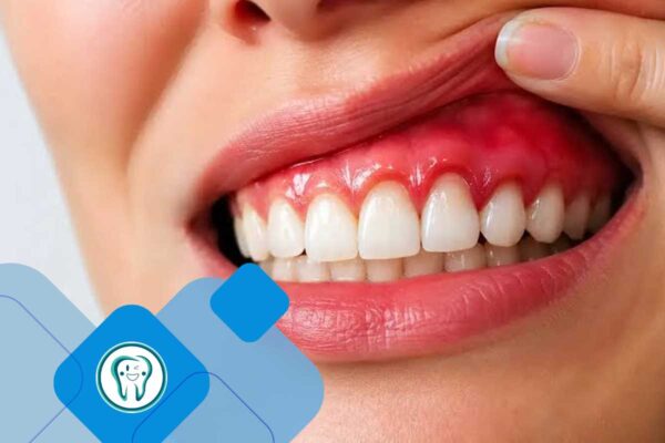 کلینیک تخصصی دندانپزشکی دکتر محسن بیاتی 19 درد لثه